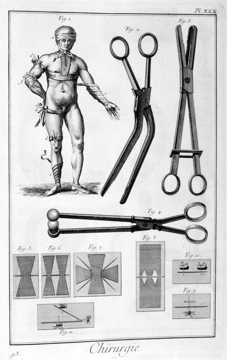Kirurgi, 1751-1777 af Unbekannt