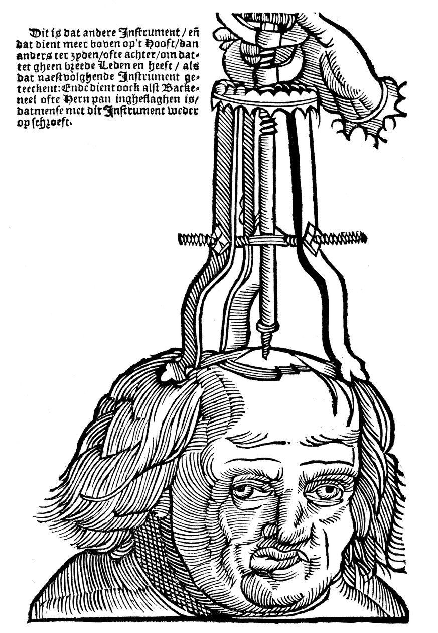 Trephination, 1593 af Unbekannt