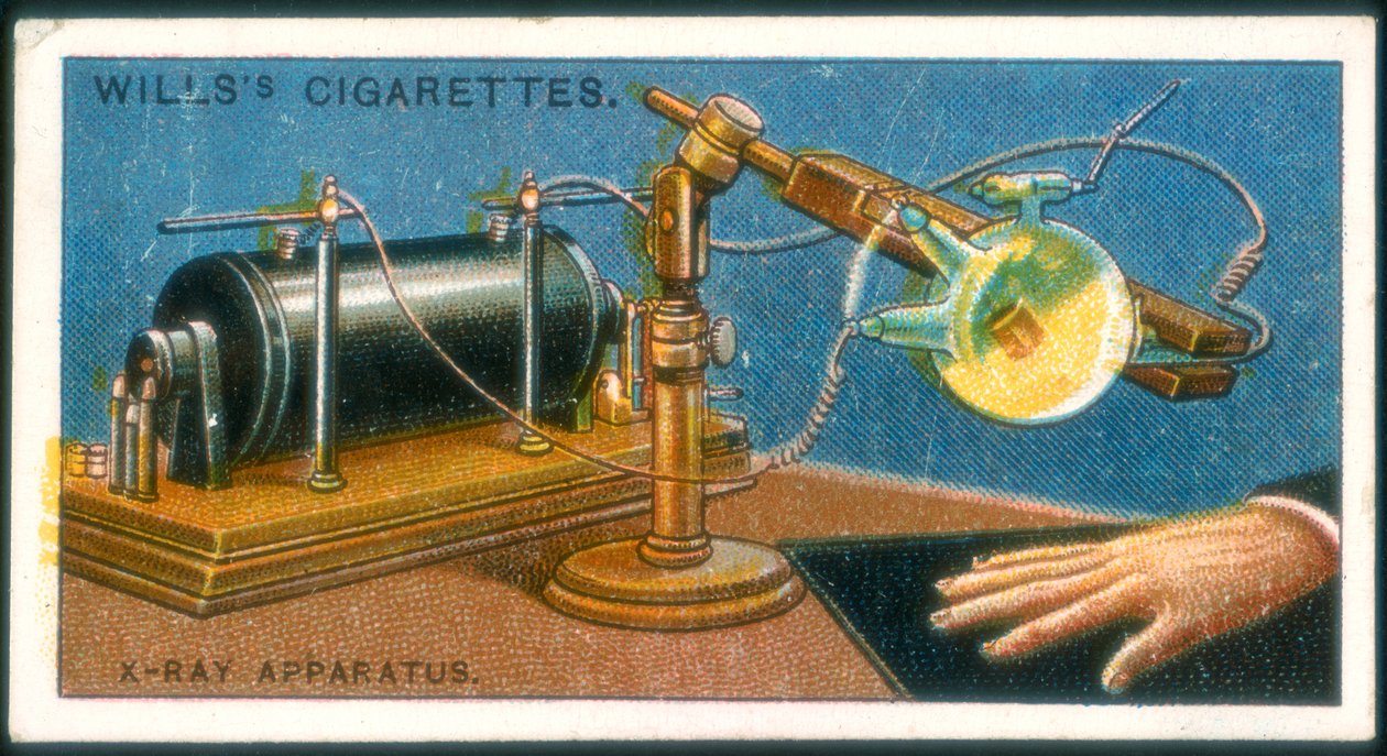 Røntgenapparat, 1915 af Unbekannt