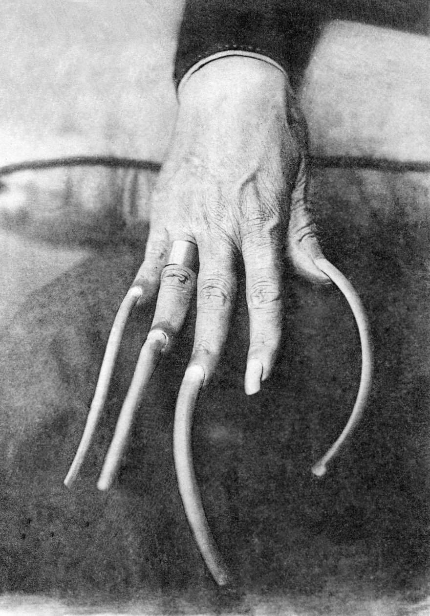 Monstrøs ejendommelighed: en hånd med meget lange negle. Kina 1910 om Historisk foto, lange fingernegle, Kina, ca. 1910 af Unbekannter Künstler