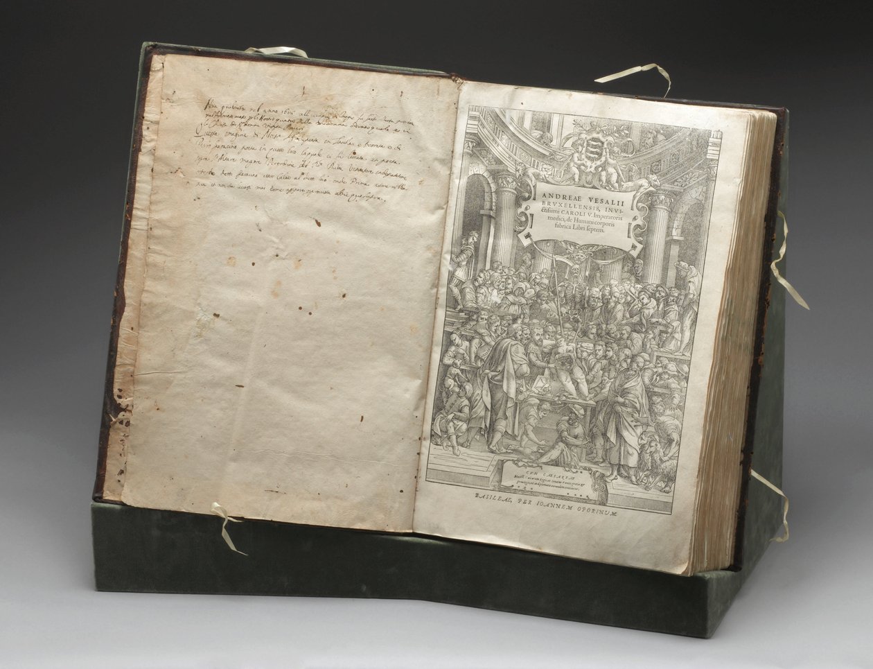 Patologi, Dissektioner Træsnit af Andreas Vesalius, der dissekerer et kadaver af Unbekannt