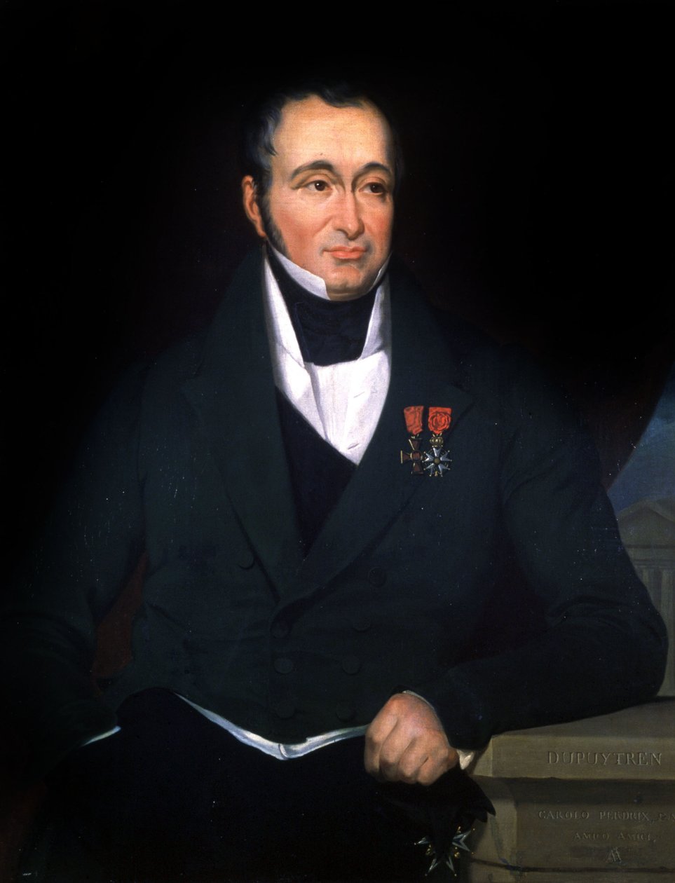 Lægen Dupuytren, ca. 1820 (maleri) af Unbekannter Künstler