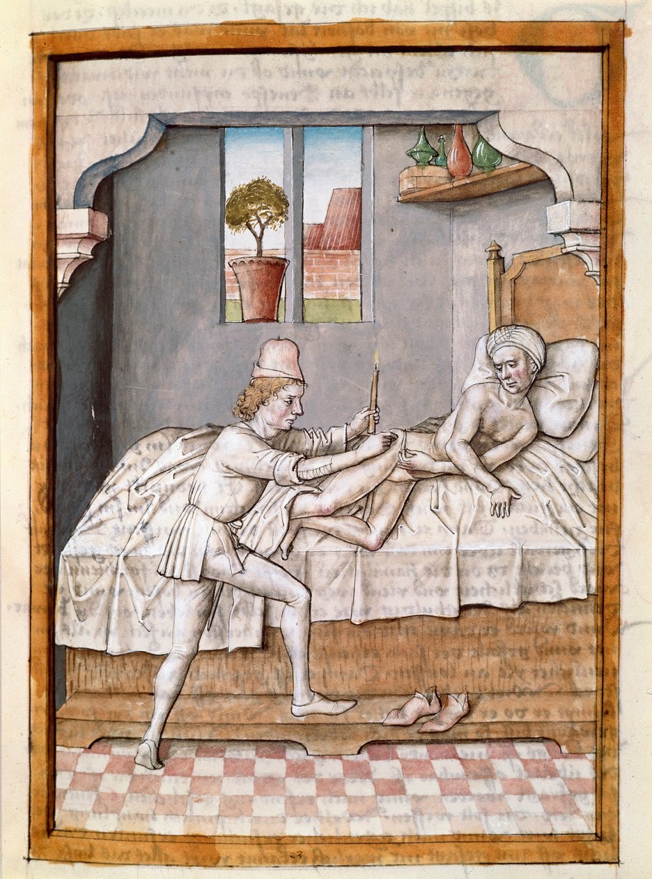 En læge behandler en miniaturepatient fra en tysk oversættelse af fablerne om "Kalila (Calila) og Dimna" af Bidpai. (ms. 1389, fol. 23) omkring 1480 Chantilly, museum Conde af Unknown artist