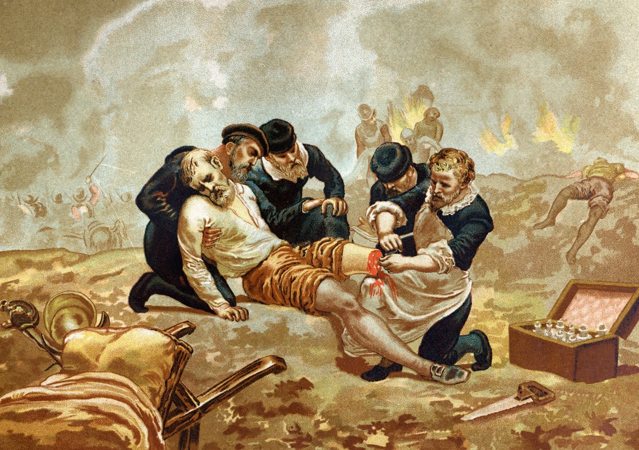 Ambroise Pare Medicine og fransk kirurg (ca. 1509-1590) praktiserer ligering af arterier efter amputation. af efter hombres y Mujeres celebres. Barcelona 1877. af Unknown artist