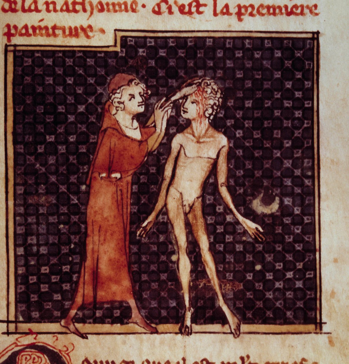 Anatomisk figur: Kirurgen skærer ind i en patients pande. Miniature fra manuskriptet "" Surgery" (Folio 8) skrevet af Henri de Mondeville (kirurg hos Philippe Le Bel professor i anatomi) af Unknown artist