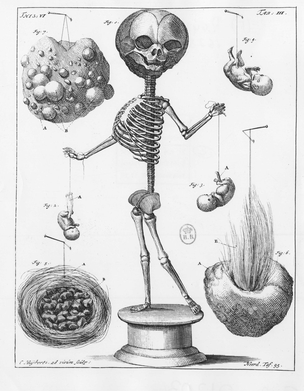 Anatomisk plade, der forestiller et skelet, af Frederik Ruysch (1638-1731), hollandsk anatom. af Unknown artist