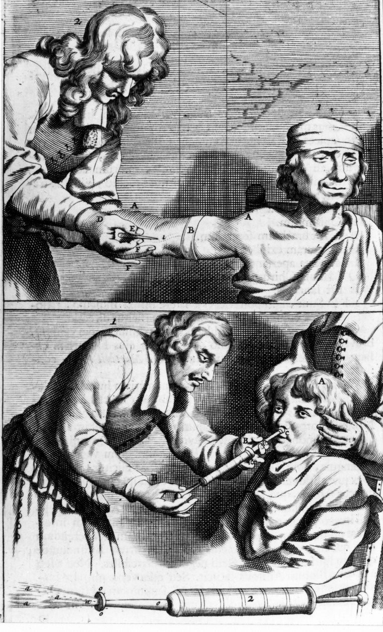 Blødning og nasal brusebad af Johannes Sculpteti "" Armamentarium Surgery"" Amsterdam 1672 af Unknown artist