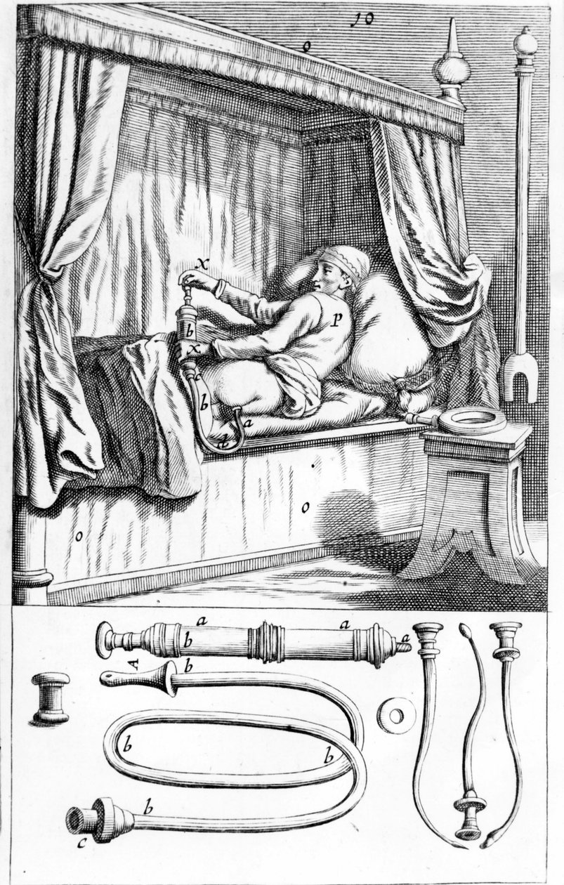 Clystère (til lavementer) af Johannes Sculptetus "" Armamentarium Surgical"". Venedig 1665 af Unknown artist