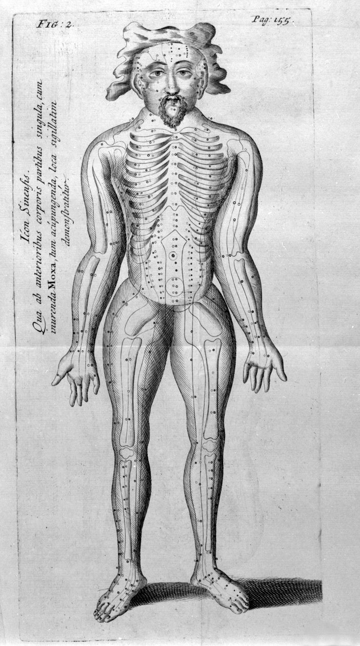 De Acupunctura af W.Ten Rhijn. London 1683. Første vestlige tekst, der omhandler akupunktur. af Unknown artist