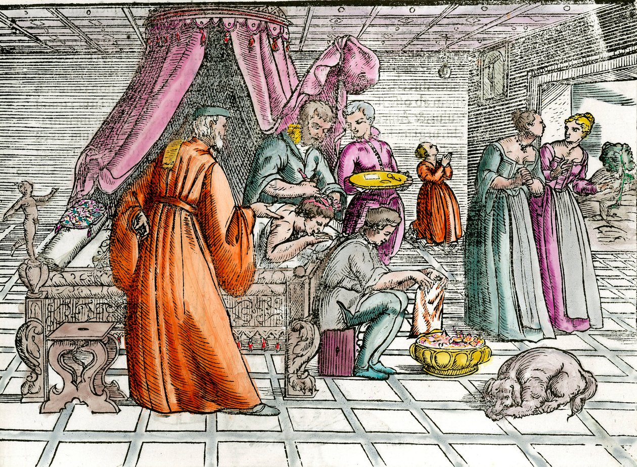 Læge: "" En trepanation""" En kirurg opererer sin patients kranie. Indgravering af privatsamlingen fra det 16. århundrede af Unknown artist