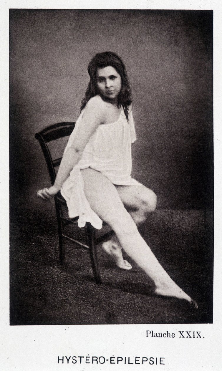 Hystero Epilepsie - Contracture in "" Fotografisk ikonografi af Salpétrière: service of Mr. Charcot" af Paul Regnard og Bourneville af Unknown artist