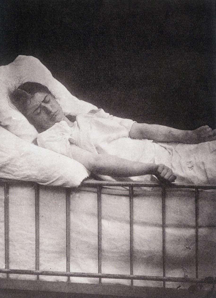 Hystero Epilepsie - Stivkrampeangreb i "" Fotografisk ikonografi af Salpétrière: service of Mr. Charcot"" af Paul Regnard og Bourneville af Unknown artist