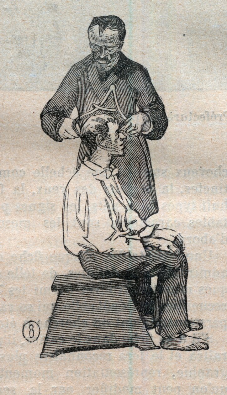 Retlig antropometri eller bertillonnage, metode af Alphonse Bertillon (1853-1914): måling af kraniets tværgående diameter - gravering i "" La Science francaise" af Unknown artist