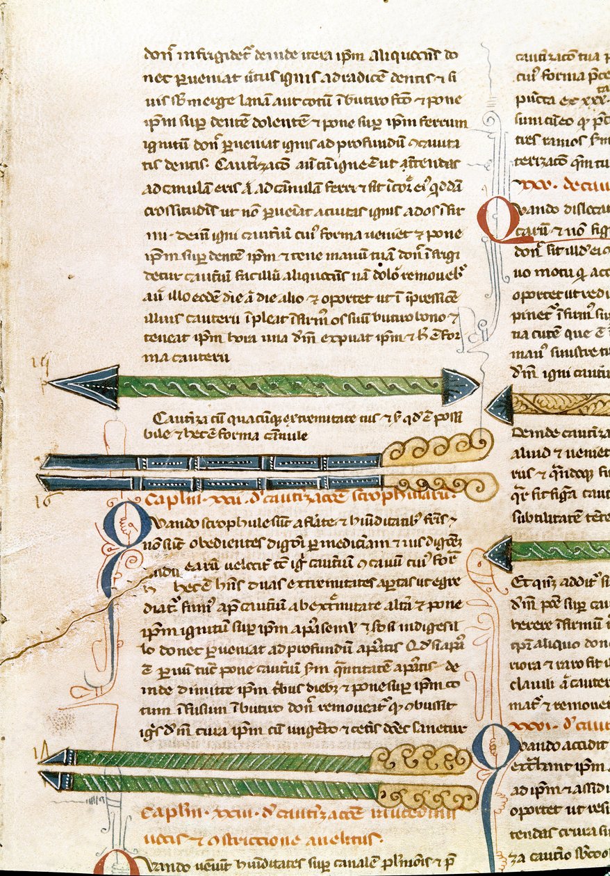 Manuskriptside "Kirurgi" (MS. LAT.VII XXXII-3023) af Guillaume de Salice (Guglielmo da Saliceto) (1207-1270) munk og læge. Biblioteca Marciana Venedig fra det 14. århundrede af Unknown artist