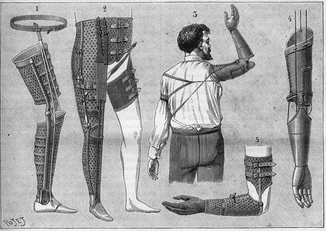 Moderne apparat til amputering. 1) kunstigt ben med bælte, 2) apparat til dearticules låret, 3 og 4 kunstige arme opfundet og bygget af M.L Matthieu til afdøde Roger, 5) kunstig arm med hånd, tommelfinger og pegefinger. i "La nature" fra 1888. af Unknown artist