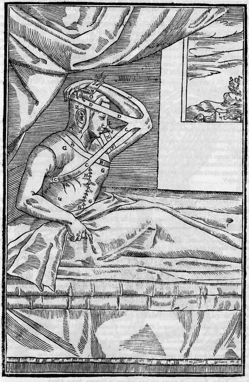 Næseoperation: Rekonstruktionskirurgi på næsen i “De curtorum chirurgia per insitionem””. Venedig af Unknown artist