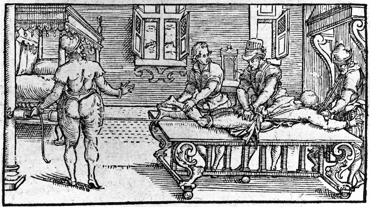 Reduktion af en dislokation, -i "Medical Treatise" af Ambroise Paré, omkring 1560. af Unknown artist