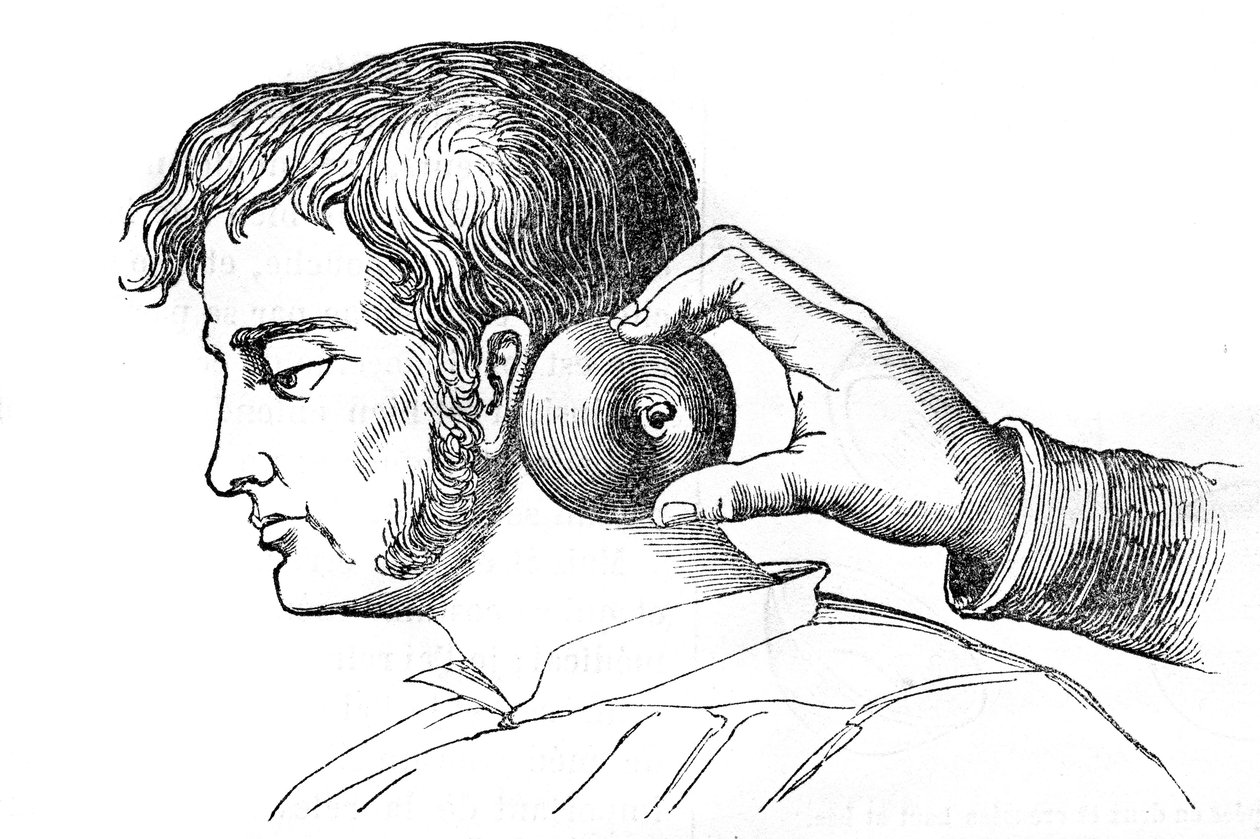 Saignee-lokaliteter - påføring af igler med et æble - indgravering i "La Santo Universelle - Medicinsk vejledning for familier"" 1852 af Unknown artist