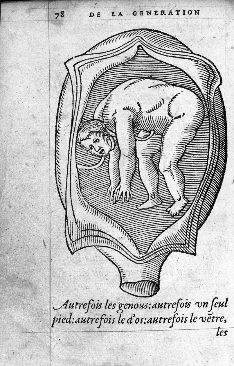 Fosterets position i livmoderen under graviditeten. Gravering fra "" De la generation des enfants"" af den franske læge og kirurg Ambroise Pare (1509-1590) 1500-tallet af Unknown artist