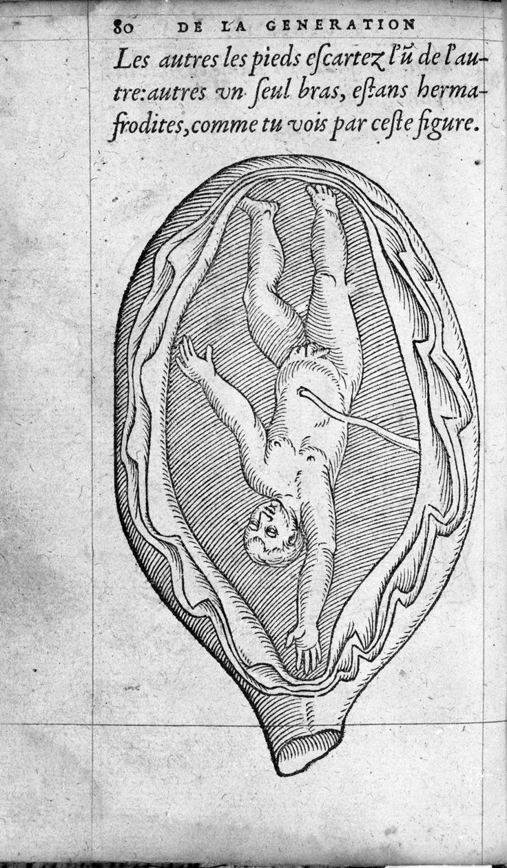 Fosterets position i livmoderen under graviditeten. Gravering fra "" De la generation des enfants"" af den franske læge og kirurg Ambroise Pare (1509-1590) 1500-tallet af Unknown artist