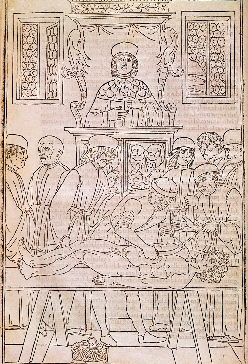 Obduktion. Codice. Liget af en død mand dissekeres af læger til en anatomiundersøgelse. “” Fasciculus Medicinae””. Codex af en læges fascicle af Johannes Kethan af Unknown artist