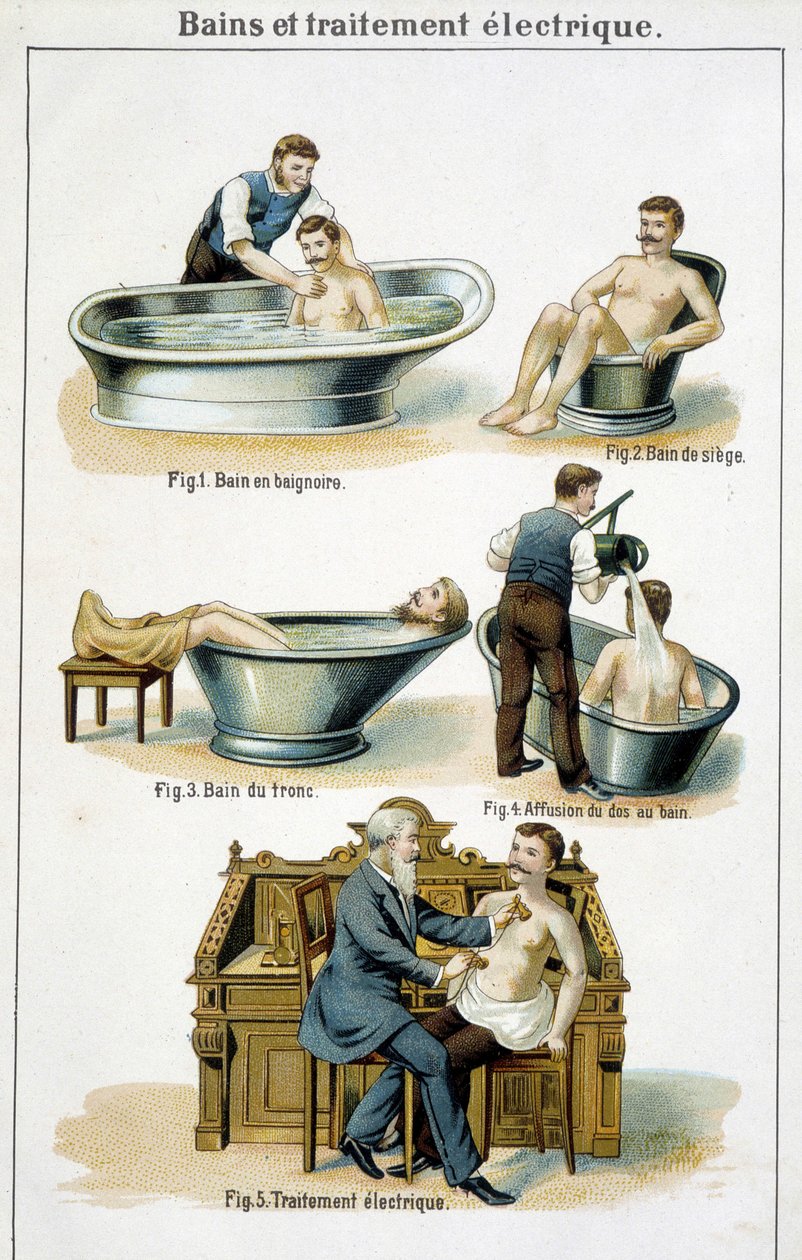 Bade og el-behandling: 1) Badekar, 2) Sædebadekar, 3) Bagagebad, 4) Tilbage til bad, 5) El-behandling - i "Bilz, Natural Medication", slutningen af 1800-tallet af Unknown artist