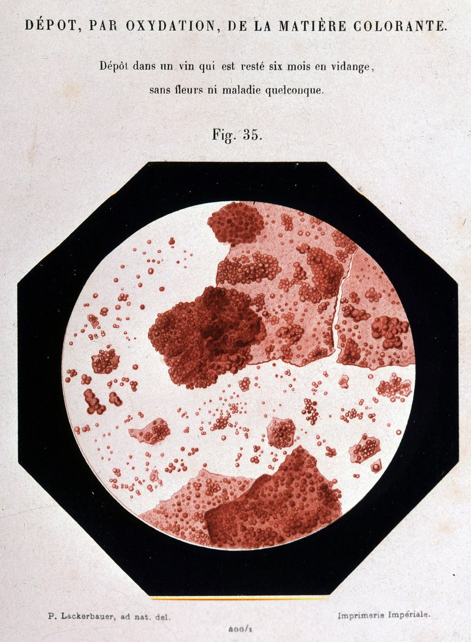 Aflejring, ved oxidation, af farvestoffet: Aflejring i et sigte, som har været tømt i seks måneder uden blomster eller nogen sygdom. 400/1 mikroskopisk visning. Studie om vin 1866 af Pasteur. af Unknown artist