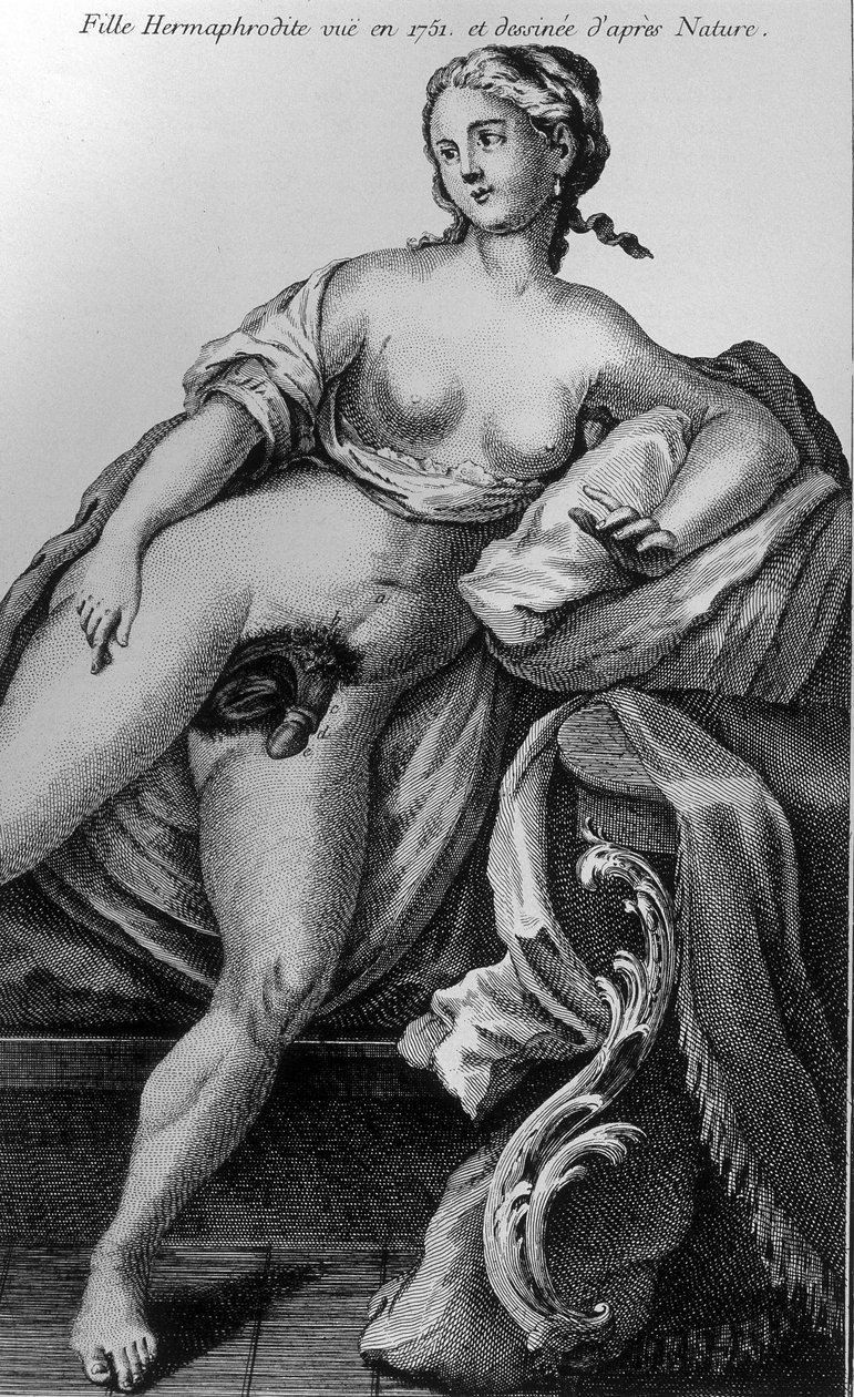 Hermafrodit-pige set i 1751 og hentet fra naturen. af Unknown artist