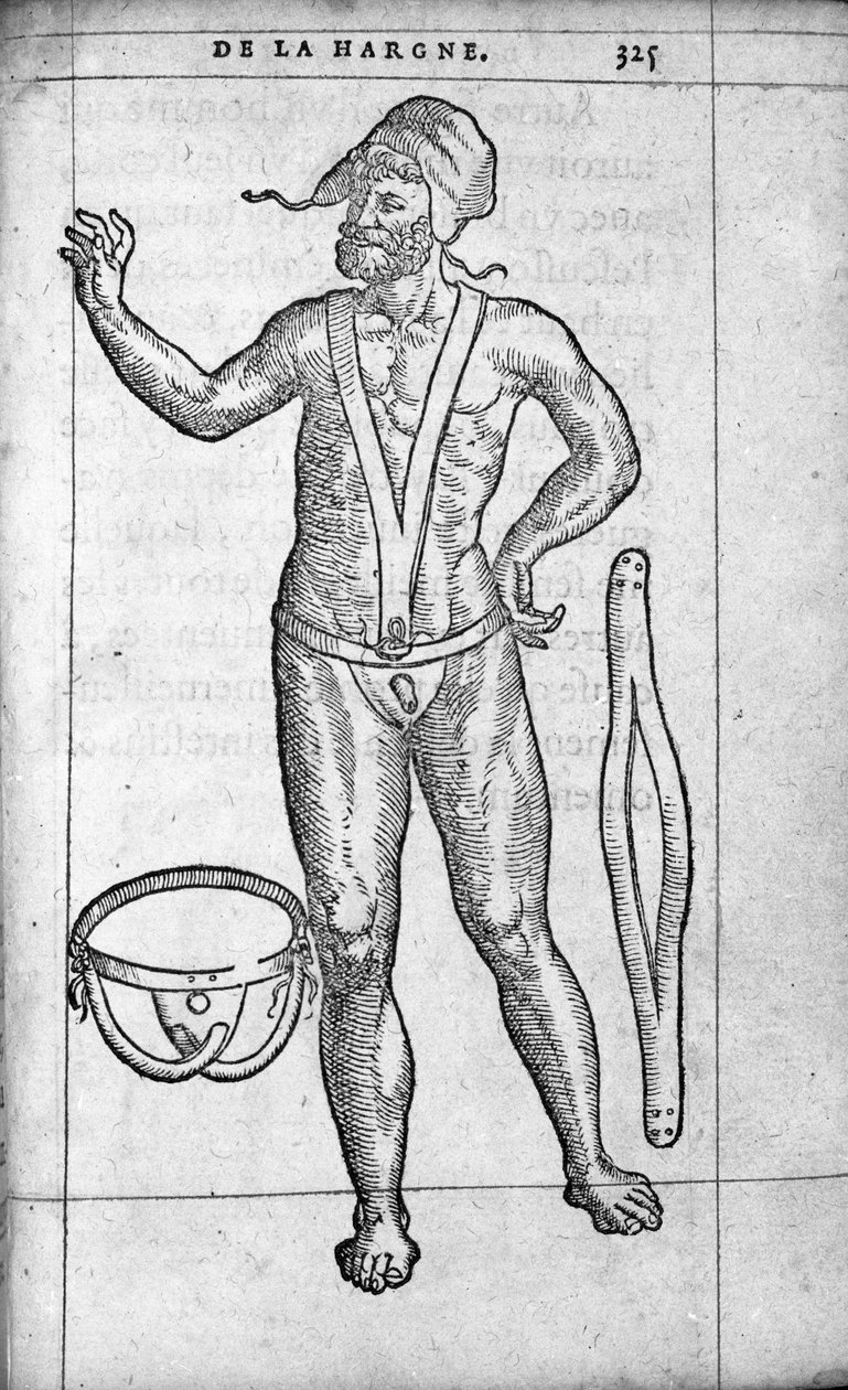 Medicin: et hernial bælte. Gravering fra "" De la hargne"" af den franske læge og kirurg Ambroise Pare (1509-1590) 1500-tallet af Unknown artist