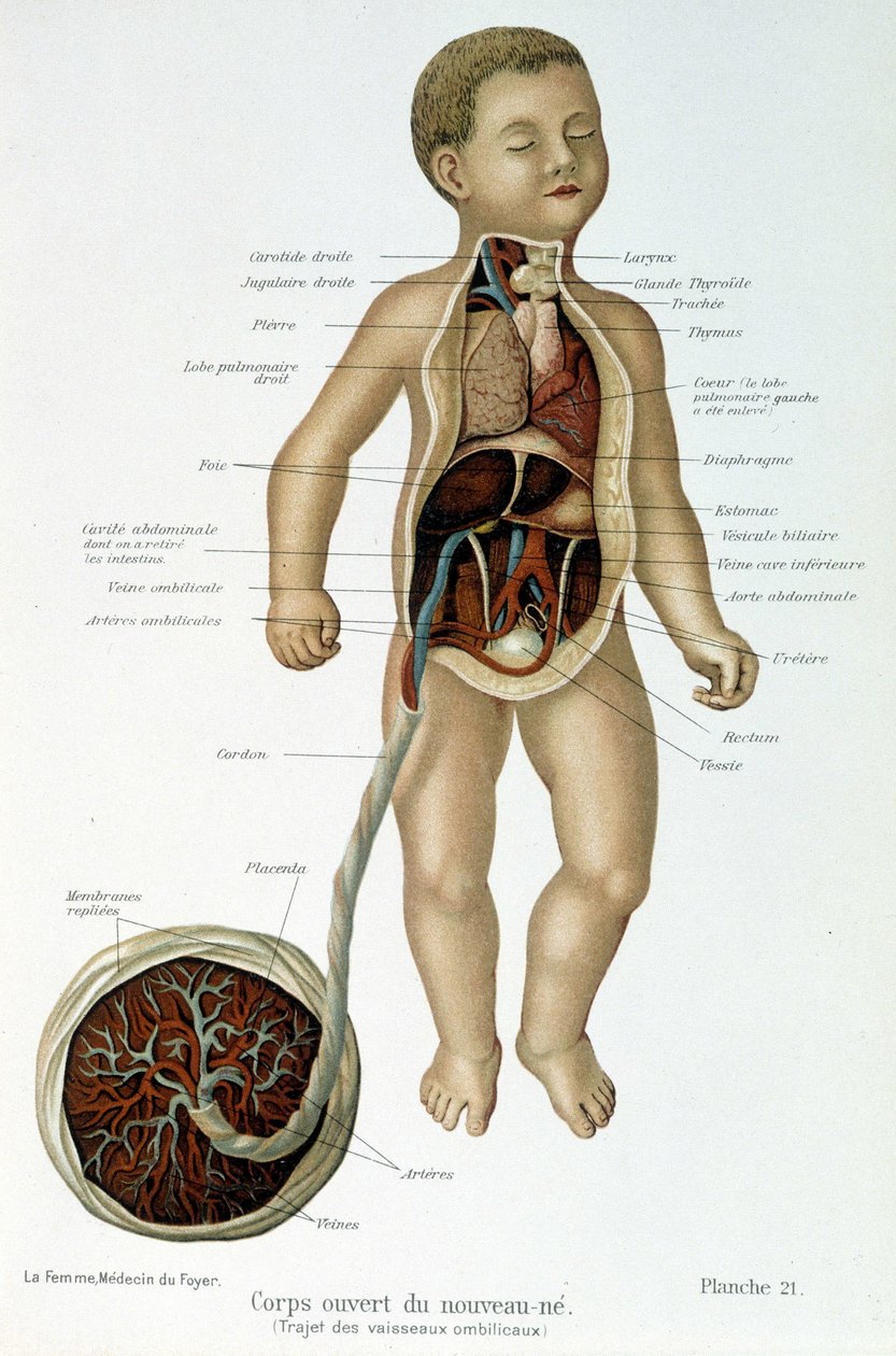 Medicin: nyfødt (afhudet i barmen). af Unknown artist