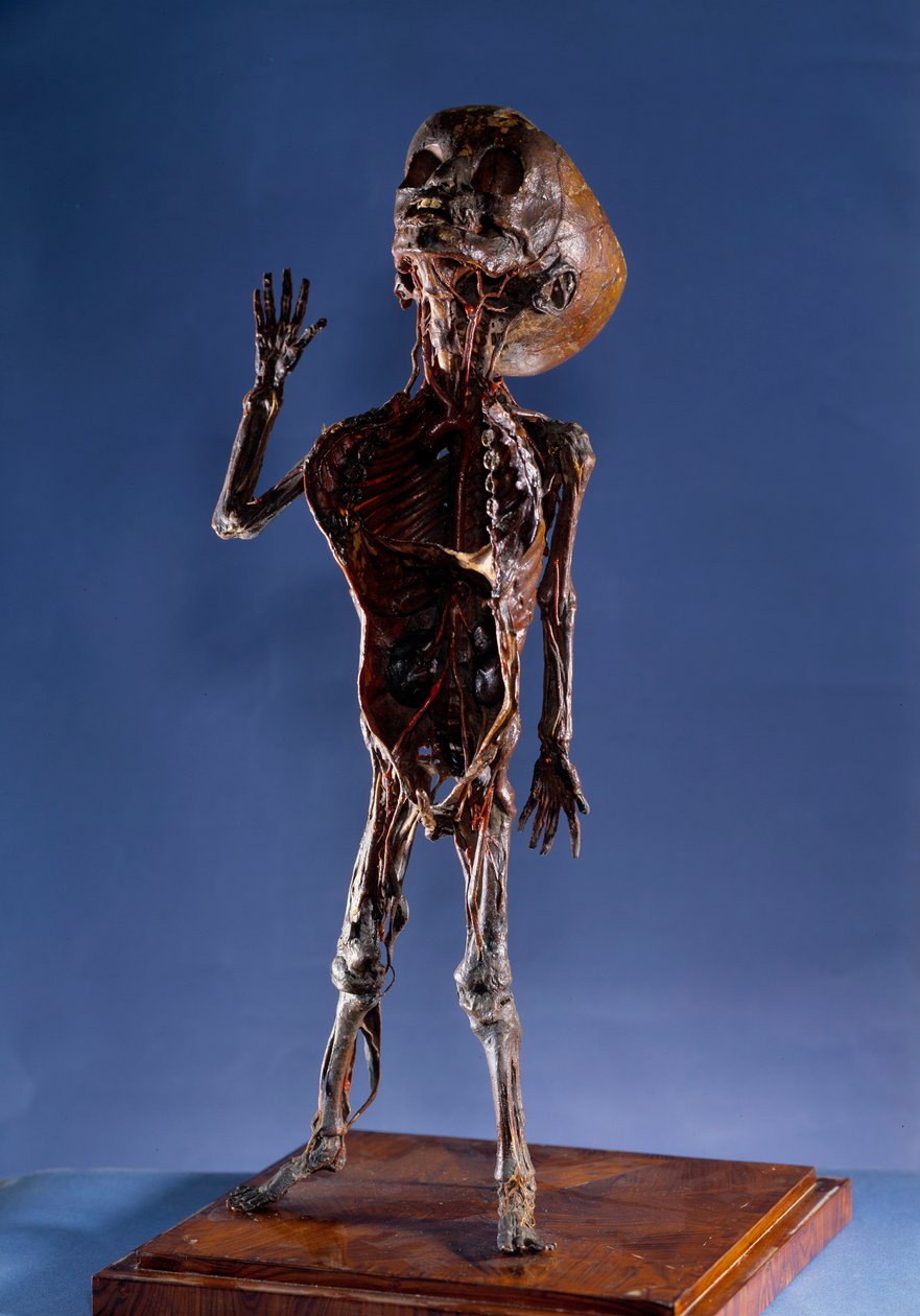 Medicin: skræl figur. 1700-tallets privatsamling af Unknown artist