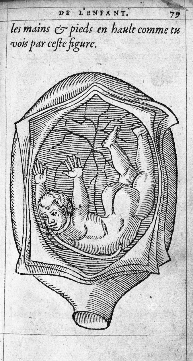 Fosterets position i livmoderen under graviditeten. Gravering fra "" De la generation des enfants"" af den franske læge og kirurg Ambroise Pare (1509-1590) 1500-tallet af Unknown artist