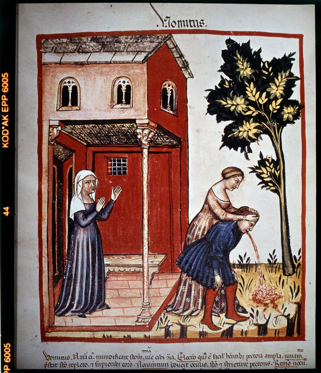 Afhandling om medicin "Tacuinum sanitatis"" fra det 14. århundrede: opkastning. B.N., Wien. af Unknown artist
