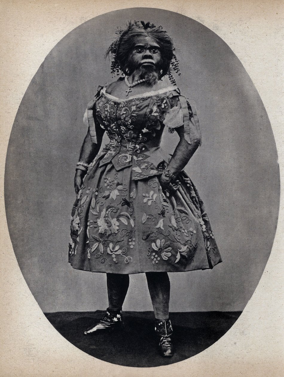 Monstrene, hundekvinden. Fotografi, slutningen af ​​det 19. århundrede, Paris. Saml. Selva. af Unknown photographer