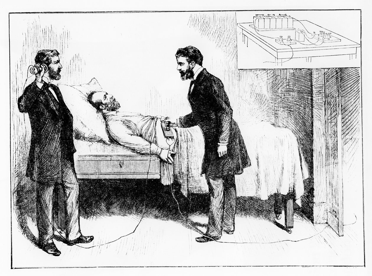 Præsident Garfield (1831-81) ligger med en uopdaget kugle i sig, 1881 (sort foto) af W. Shinkle