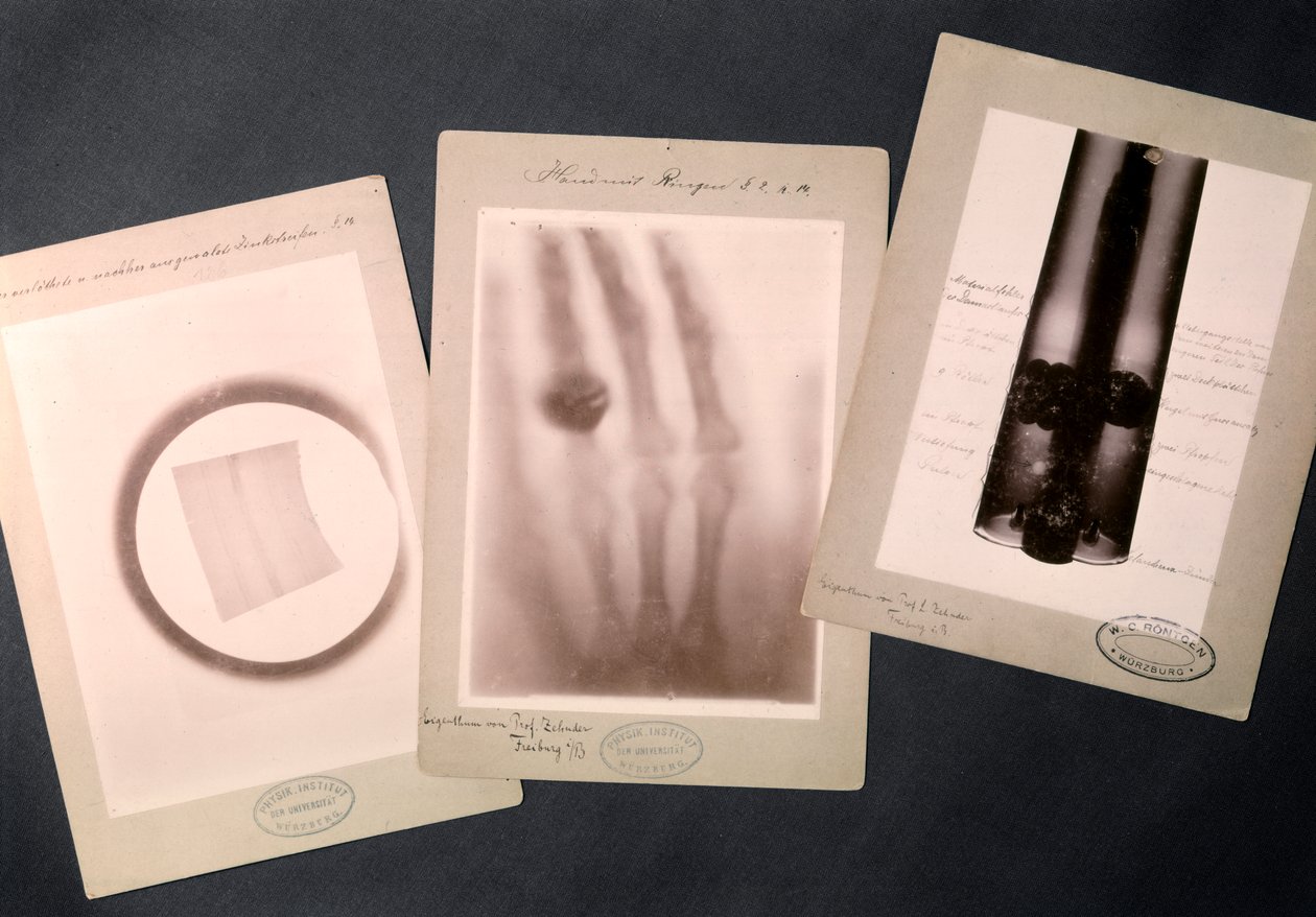 Originale røntgenbilleder af Roentgen, der viser (radiografi) af Wilhelm (after) Röntgen
