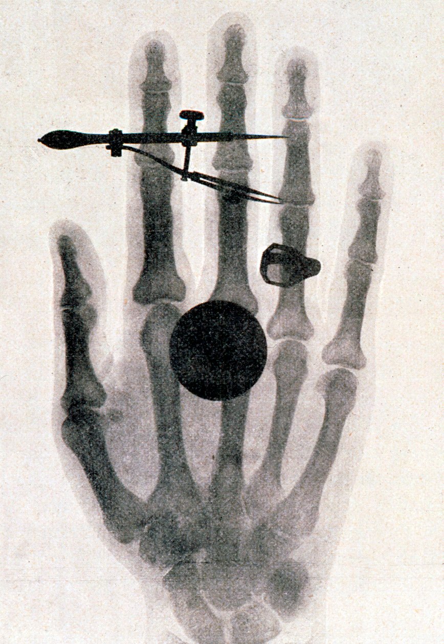 Wilhelm Roentgens røntgenfotografi af sin kones hånd, 1896 af Wilhelm Conrad Rontgen