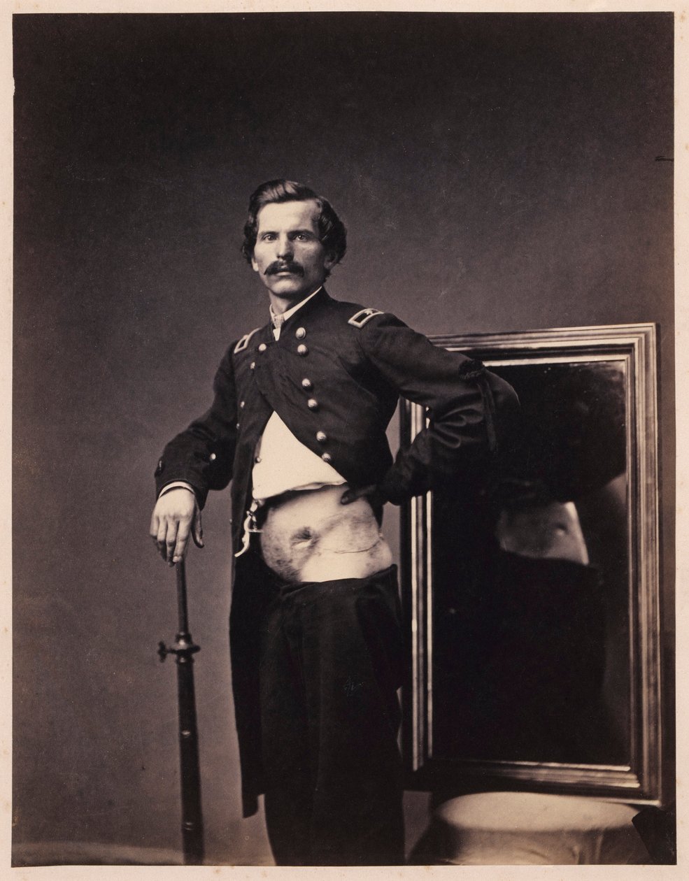 Major H. A. Barnum, Genopretning efter et gennemtrængende skudsår i maven med perforering af venstre Ilium, fra det fotografiske katalog over den kirurgiske afdeling af William Bell