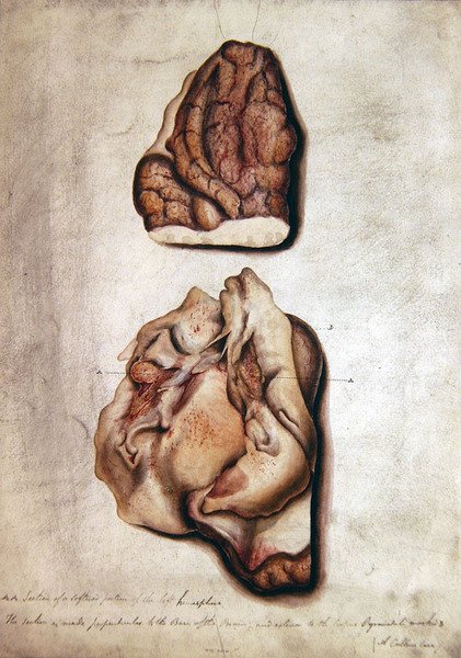 Study of Brain III, ca. 1850 (akvarel på papir) af William Lover