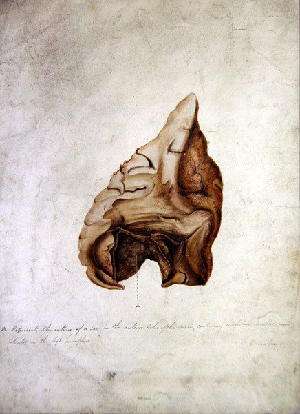 Study of Brain I, ca. 1850 (akvarel på papir) af William Lover