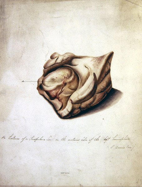 Study of the Brain II, ca. 1850 (akvarel på papir) af William Lover