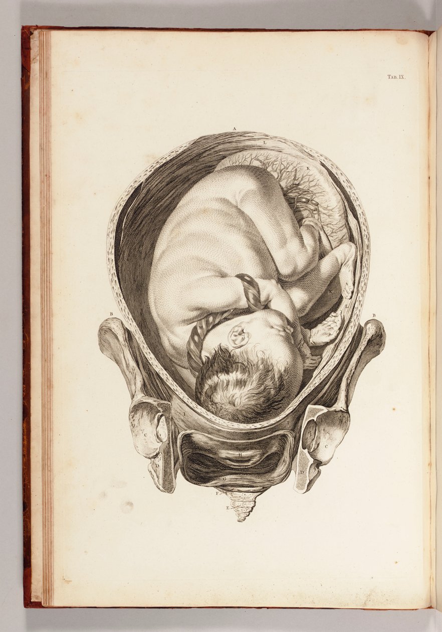 Indgravering af et barn i livmoderen fra "Et sæt anatomiske tabeller, med forklaringer og en forkortelse af jordemoderpraksis", 1754 af William Smellie