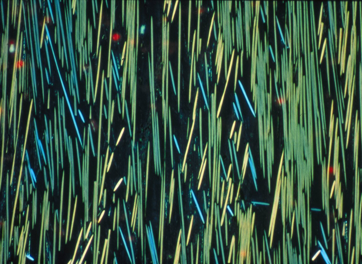 KOMPOSIT, LM PMC kulfiber i en polymermatrix af Frederick (attr. to) Barnard