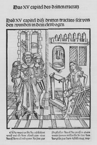 The Book of Cirurgia af Hieronymus Brunschwig (litho) af (after) German School