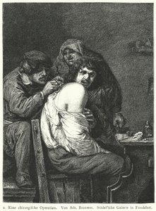 Rygoperationen af Adriaen (after) Brouwer