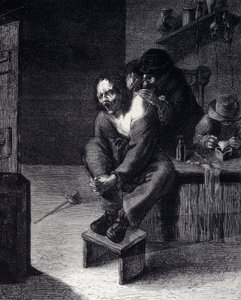 Den kirurgiske operation Indgravering efter et maleri af Adrien Brauwer (udført 1608) 1600-tallet af Adriaen (after) Brouwer