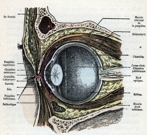 Lodret udskæring af et øjeæble med grå stær gravering fra “Nature and Man” af Rengade 1881 Privat samling af Alphonse Demarle