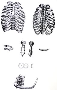 Pladerne fra den første bog af De Humani Corporis Fabrica af Andreas Vesalius