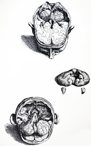Pladerne fra den syvende bog af De Humani Corporis Fabrica af Andreas Vesalius