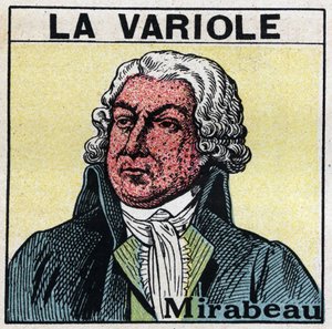 Portræt af Honore Gabriel (Honore-Gabriel) Riqueti, greve af Mirabeau (1749-1791) med ansigtet af en figur af kopper. For at undgå ar forårsaget af kopper, bør patienter behandles i værelser eller kun gå ind i rødt lys, fri for ultraviolette stråler. Anony af Anonymous Anonymous